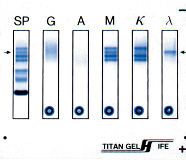 Titan Gel Immunofixation