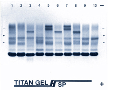 Titan Gel Protein Electrophoresis